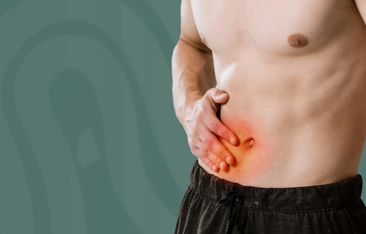 Hernias – Proctología RD Hernias | Proctóloga Santo Domingo